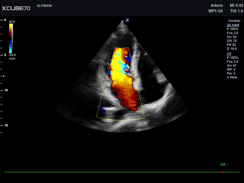 Liver in CF mode