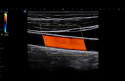 Ultrasound Image