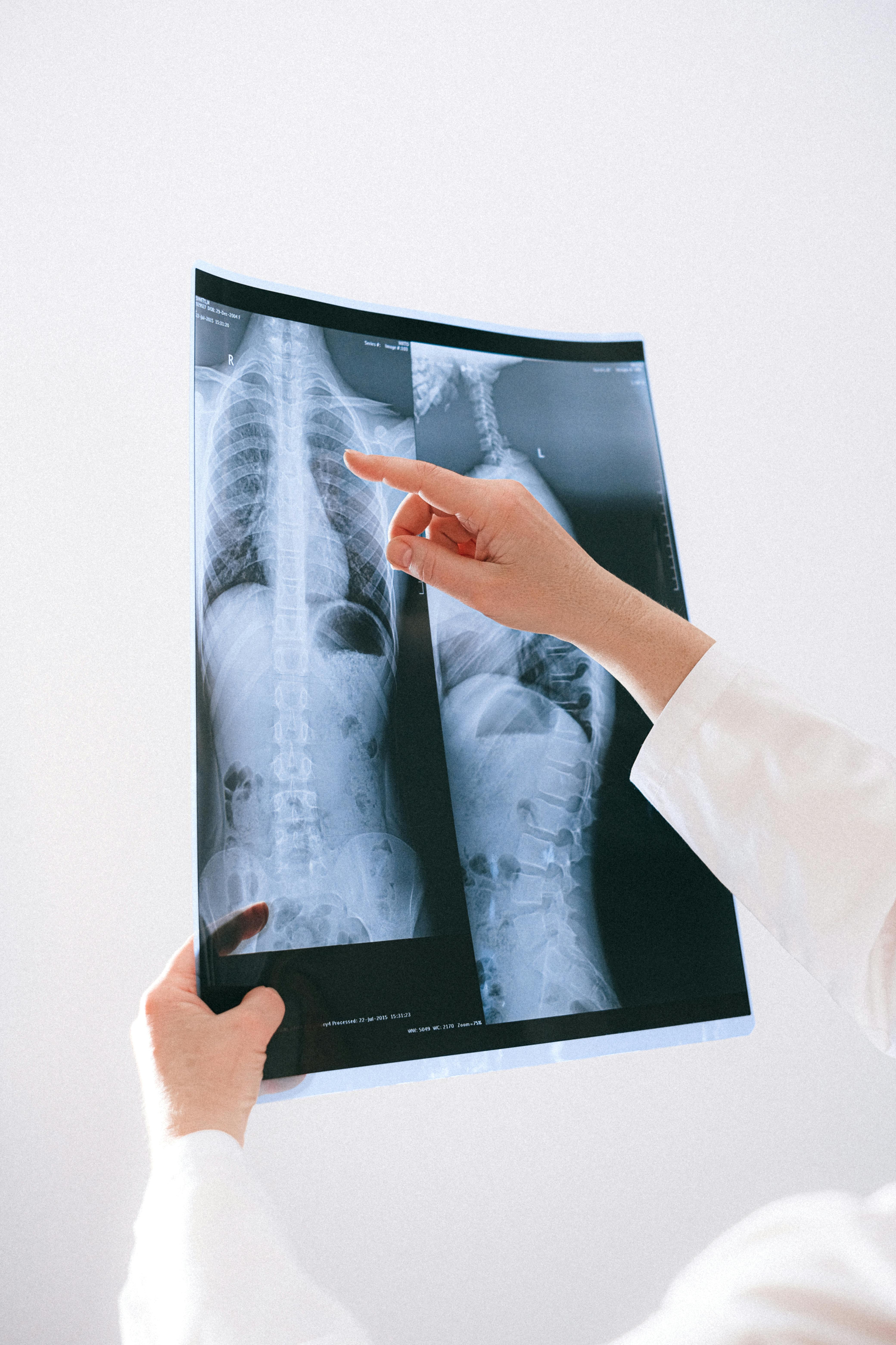 Transba Radiology equipment